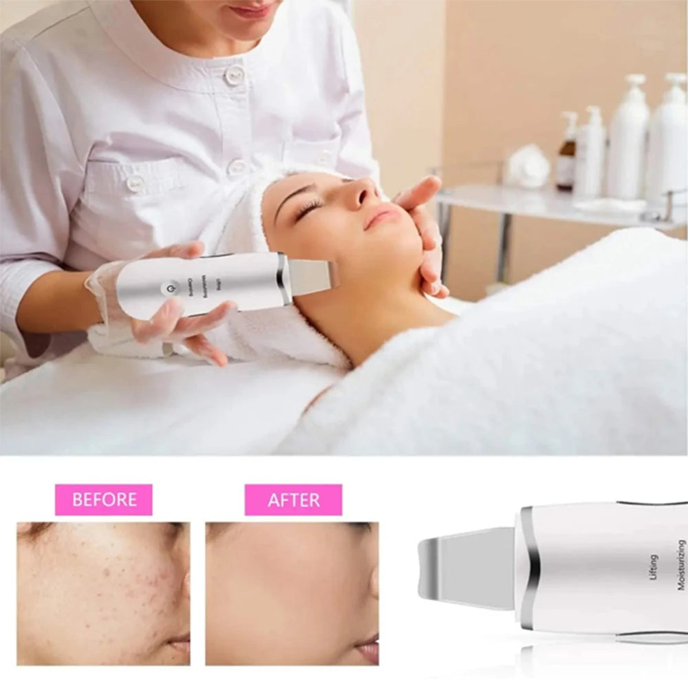 3-in-1 Ultrasonic Skin Scrubber